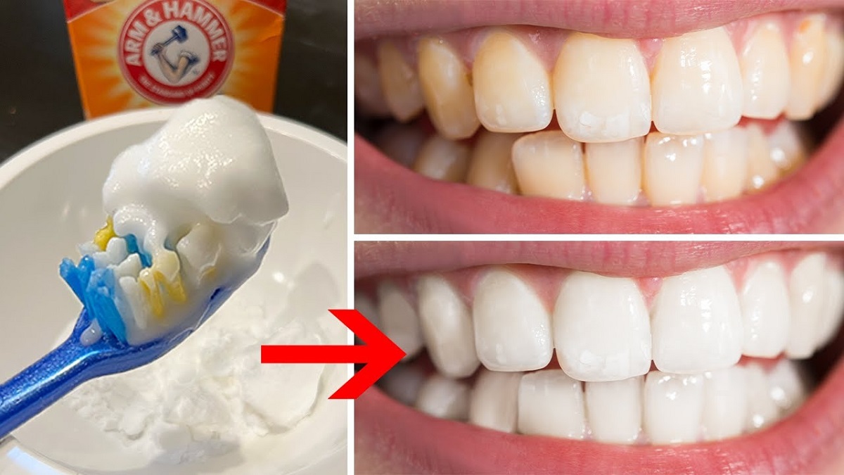 ترفندهای زیبایی قدیمی عکس 1: سفید کردن دندان با جوش شیرین