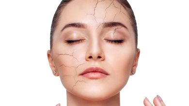 درمان خشکی پوست صورت و بدن
