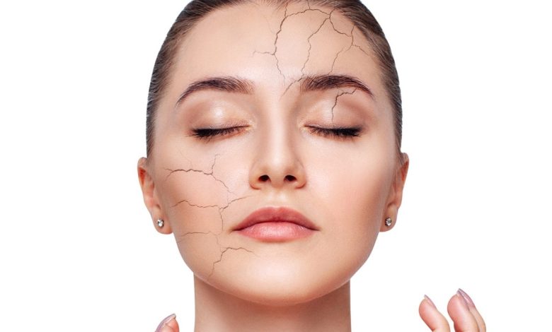 درمان خشکی پوست صورت و بدن
