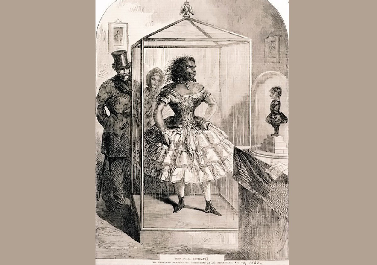 زنان ریش دار4