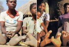 قبیله آفریقایی با پاهای شترمرغ-قبیله دوما-زیمباوه