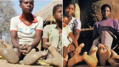 قبیله آفریقایی با پاهای شترمرغ-قبیله دوما-زیمباوه