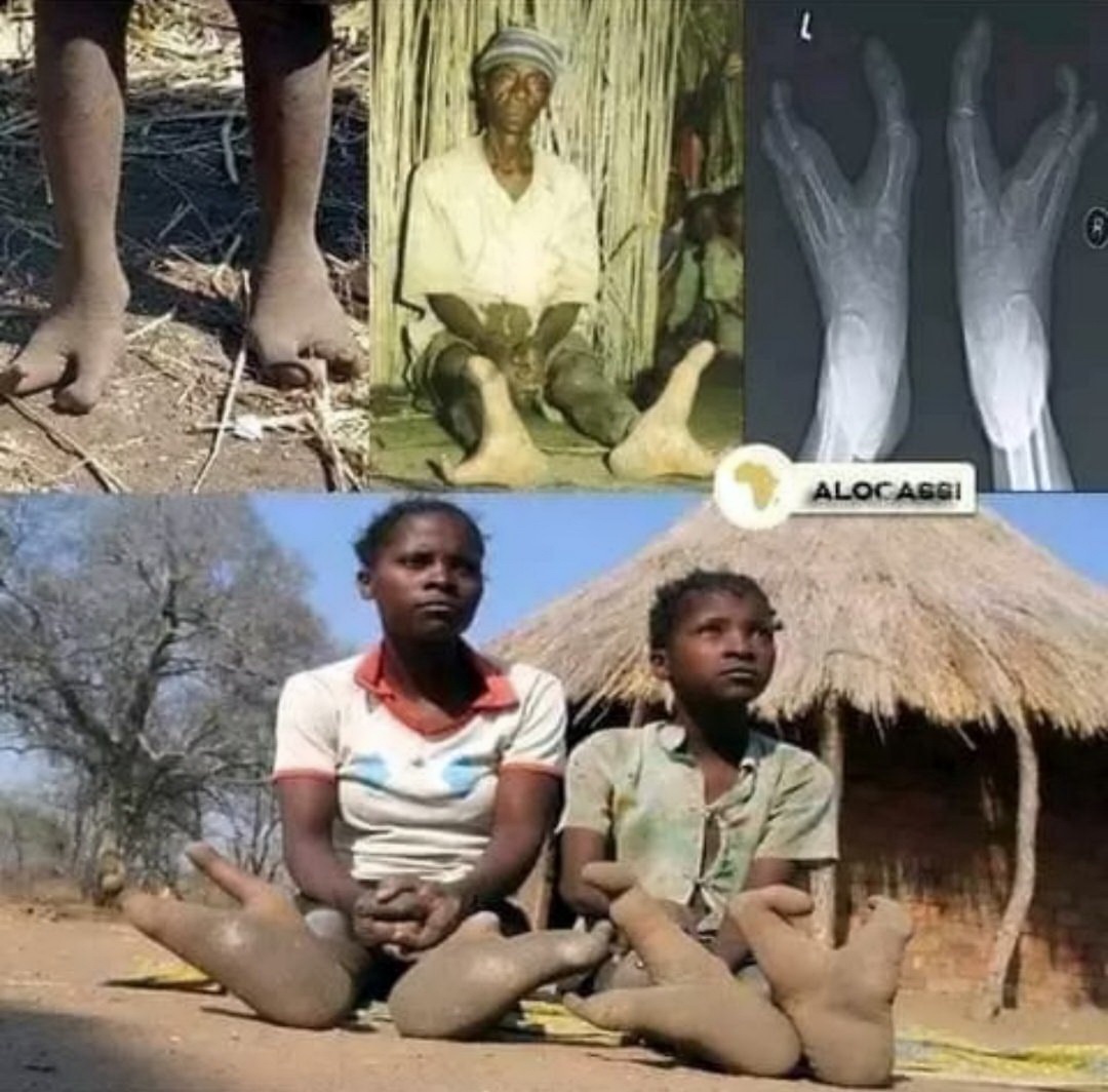 قبیله آفریقایی با پاهای شترمرغ-قبیله دوما