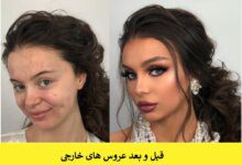 قبل و بعد عروس های خارجی