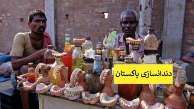دندانسازی زیر قیمت در پاکستان