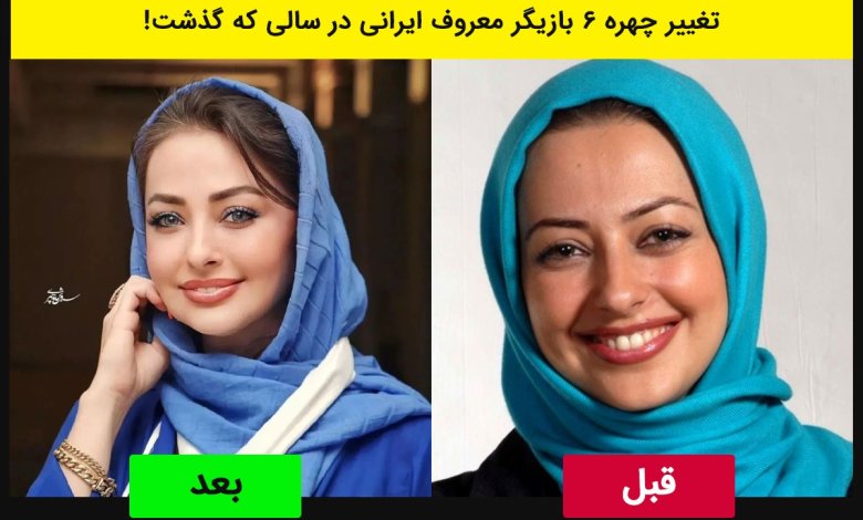 تغییر چهره 6 بازیگر معروف ایرانی