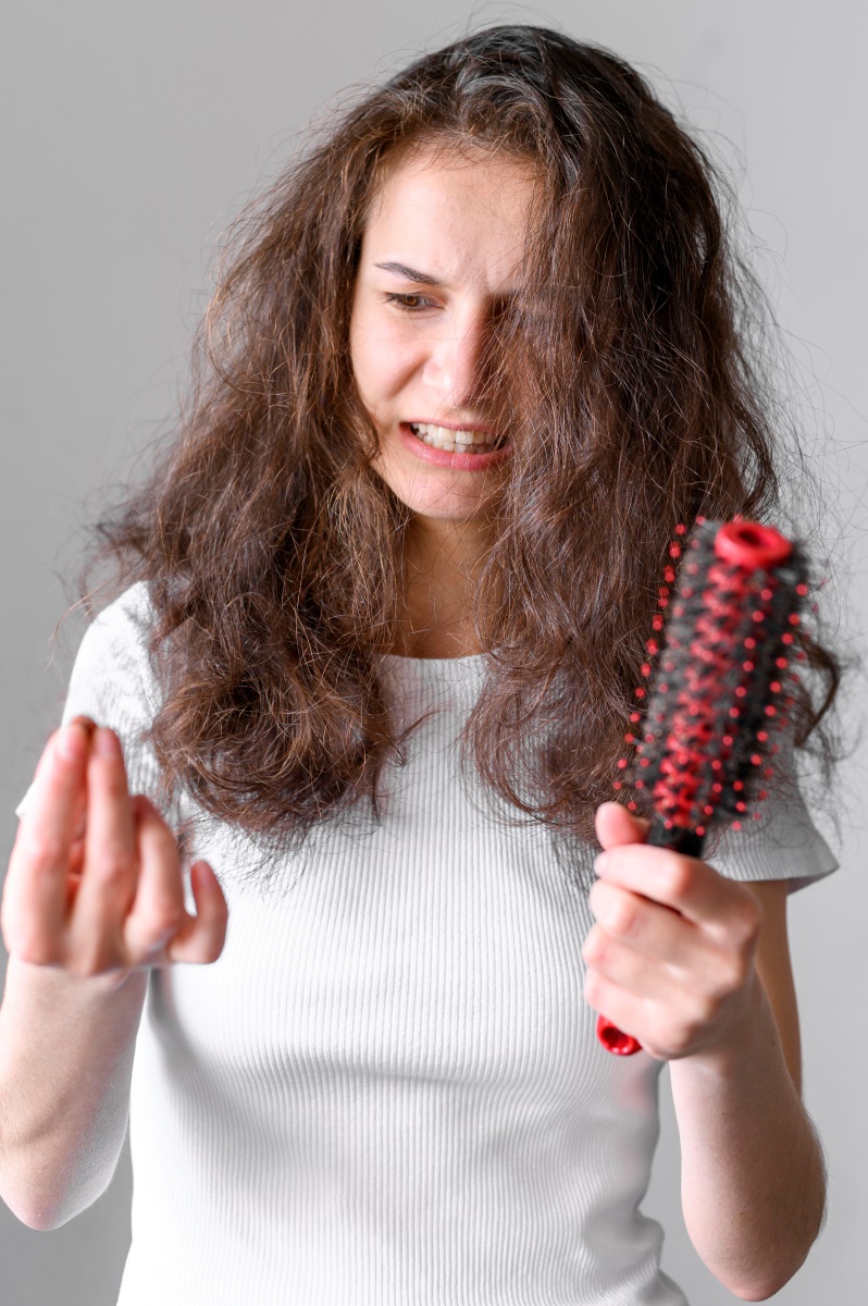 درمان ریزش موی زنان2