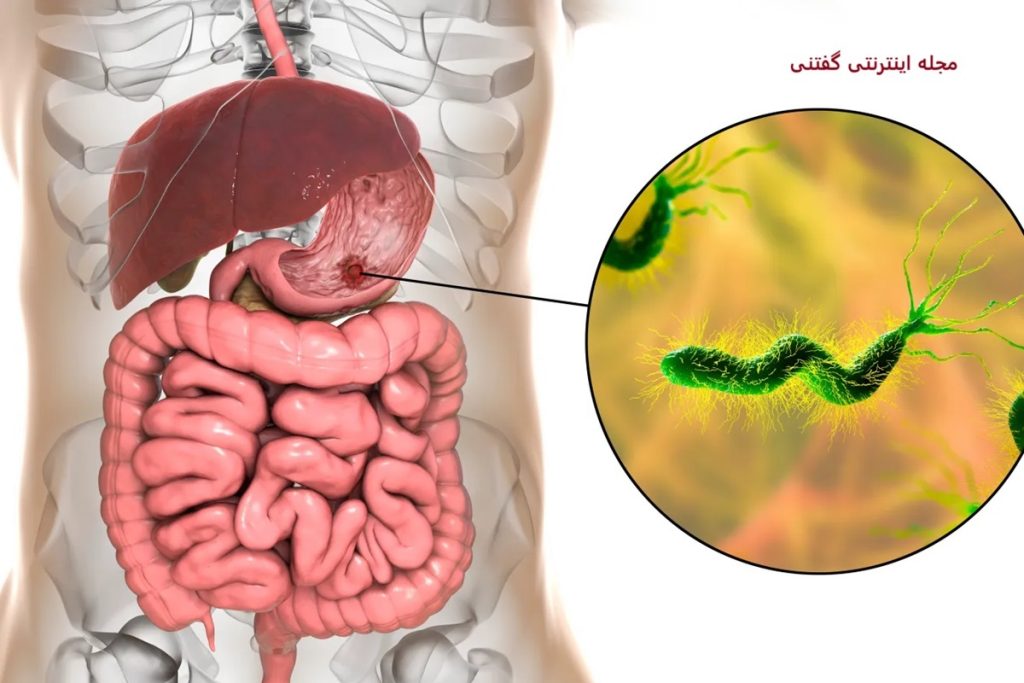 رابطه مستقیم زیادی اشتها و باکتری معده-1