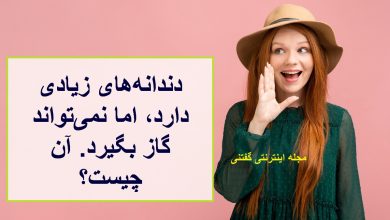 چیستان دارای دندانه زیاد ولی گاز نمیگیرد 1