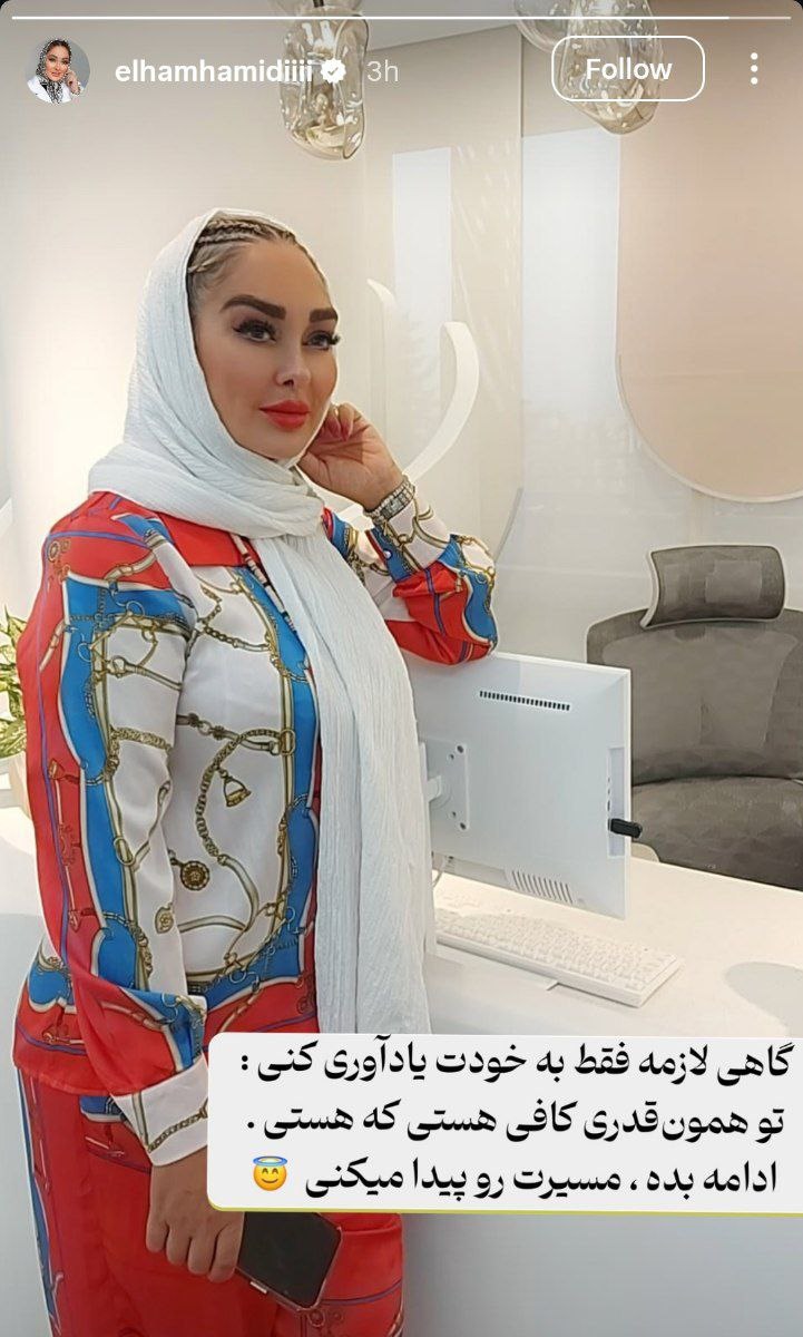 تغییر چهره الهام حمیدی بازیگر سریال آتش و شبنم 1