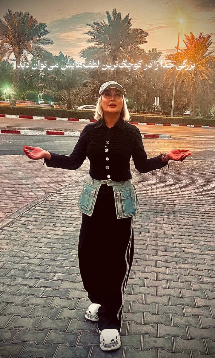 چهره جدید الهام حمیدی با عمل های زیبایی 1