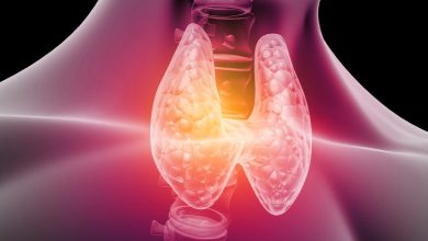 مواد غذایی مضر برای بیماران تیروئیدی