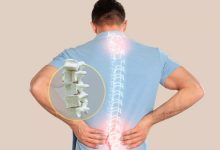 غذاهای تضعیف کننده استخوان‌ها