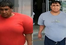 تورم بدن مرد اهل پرو بر اثر غواصی در دریا-4