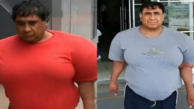 تورم بدن مرد اهل پرو بر اثر غواصی در دریا-4